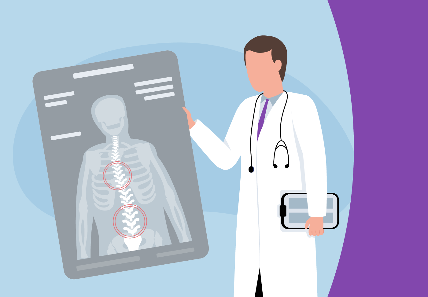 For adults with severe cases of degenerative scoliosis, spinal deformity correction may be necessary due to significant pain, limited movement or deformity.