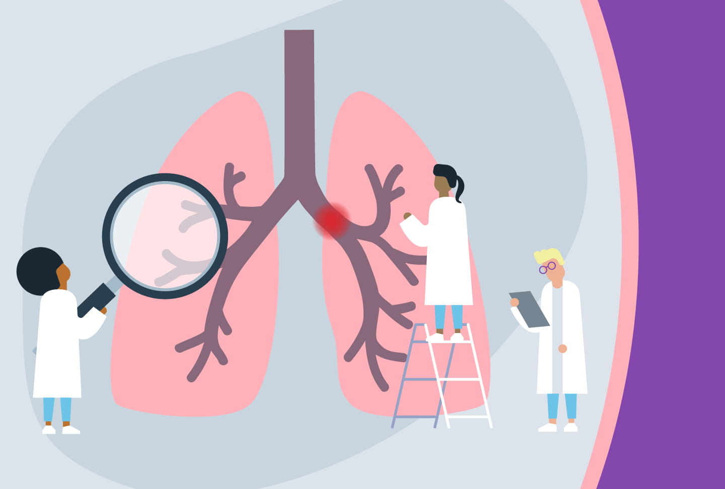 New Wellstar Health System Initiative Strives to Improve Outcomes for Patients with Pulmonary Embolisms Illustration of providers looking at blocked artery in lung