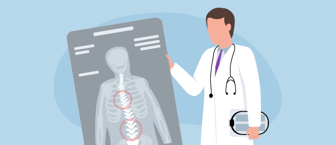 Physician examines X-ray. For adults with severe cases of degenerative scoliosis, spinal deformity correction may be necessary due to significant pain, limited movement or deformity.